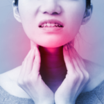 Hypothyroidism